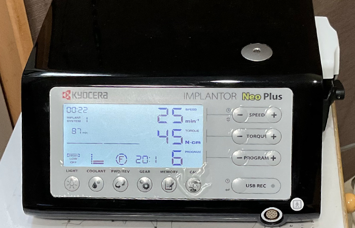 インプランター